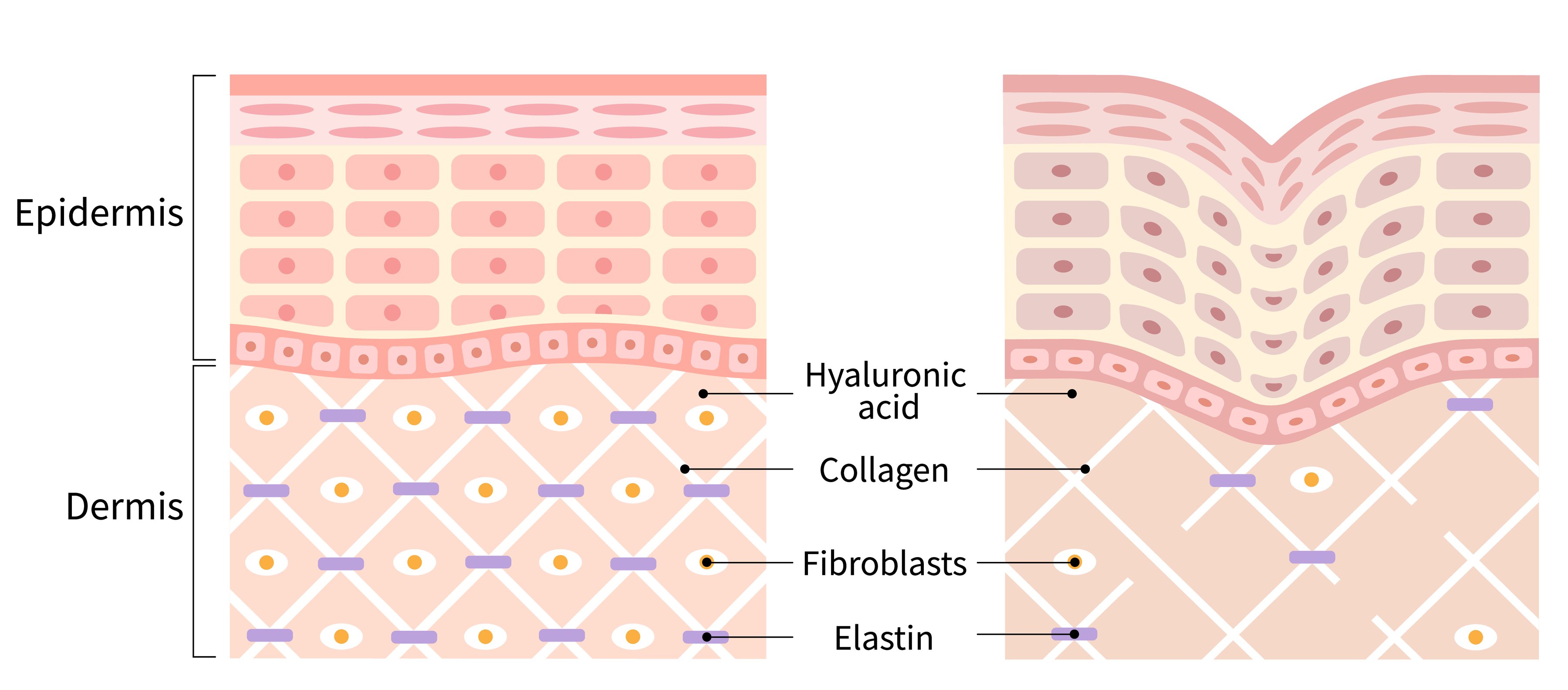 Collagen in Skin